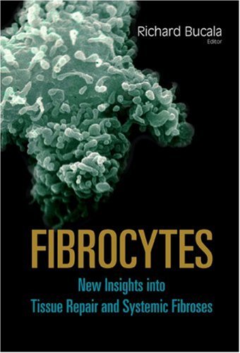 Fibrocytes : New Insights Into Tissue Repair And Systemic Fibroses.