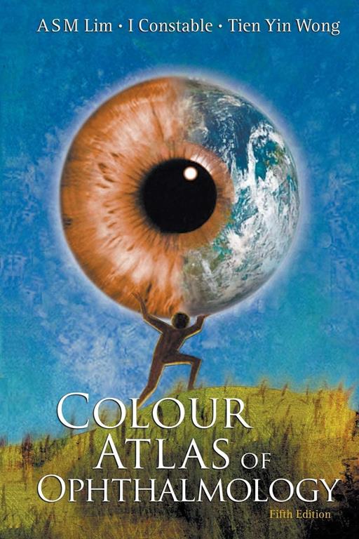 Colour Atlas of Ophthalmology (Fifth Edition)