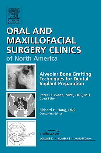 Alveolar Bone Grafting Techniques in Dental Implant Preparation, An Issue of Oral and Maxillofacial Surgery Clinics - E-Book: Number 3 (The Clinics: Dentistry Book 22)