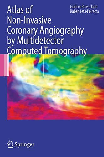 Atlas of Non-Invasive Coronary Angiography by Multidetector Computed Tomography (Developments in Cardiovascular Medicine Book 259)