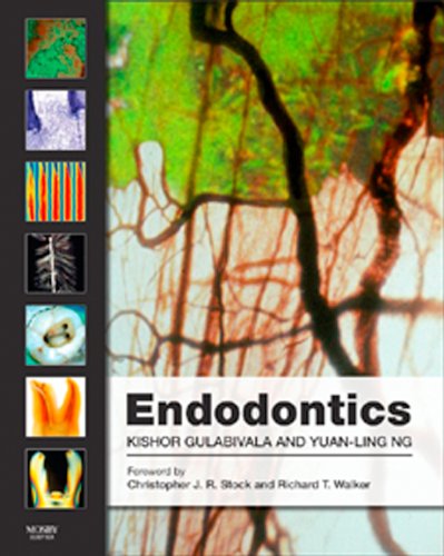 Endodontics E-Book