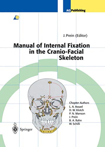 Manual of Internal Fixation in the Cranio-Facial Skeleton: Techniques Recommended by the AO/ASIF Maxillofacial Group